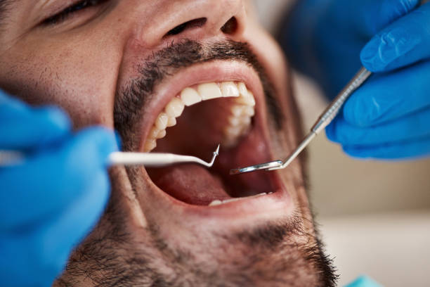 Best Emergency Treatment for Toothache in Greensboro, NC