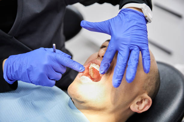 Best Emergency Root Canal Treatment in Greensboro, NC