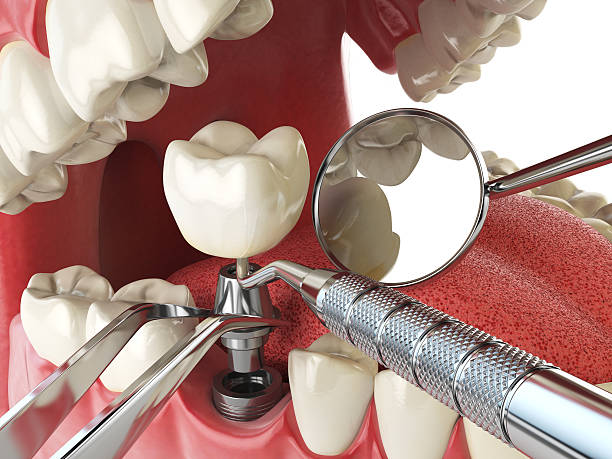 Best Emergency Dental Care for Trauma or Injury in Greensboro, NC